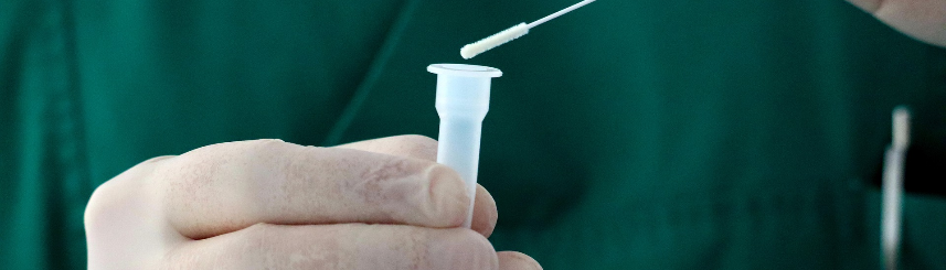 Medyk trzyma w ręku próbkę i patyczek do wymazu